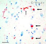 Alpha-synuclein Antibody in Immunohistochemistry (IHC)