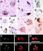 Alpha-synuclein Antibody in Immunohistochemistry (IHC)