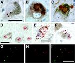 Alpha-synuclein Antibody in Immunohistochemistry (IHC)