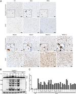 Alpha-synuclein Antibody in Immunohistochemistry (IHC)