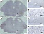 Alpha-synuclein Antibody in Immunohistochemistry (IHC)