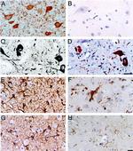 Alpha-synuclein Antibody in Immunohistochemistry (IHC)