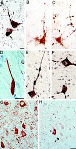 Alpha-synuclein Antibody in Immunohistochemistry (IHC)