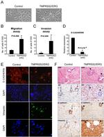 E-Cadherin Antibody in Immunohistochemistry (IHC)