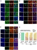 E-Cadherin Antibody in Immunohistochemistry (IHC)