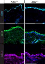 Claudin 1 Antibody in Immunohistochemistry (IHC)