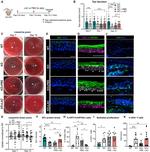 ZO-1 Antibody in Immunohistochemistry (IHC)