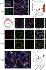 VE-cadherin Antibody in Immunohistochemistry (IHC)