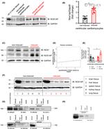 CaV1.2 Antibody in Western Blot (WB)