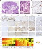 Claudin 18 Antibody in Immunohistochemistry (IHC)