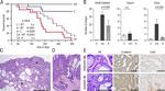 Claudin 18 Antibody in Immunohistochemistry (IHC)