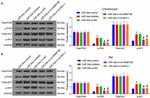 Phospho-AKT1 (Ser473) Antibody in Western Blot (WB)