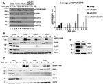 Phospho-EGFR (Tyr845) Antibody in Western Blot (WB)