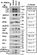 SERCA2 ATPase Antibody in Western Blot (WB)