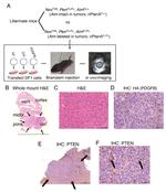 PTEN Antibody in Immunohistochemistry (IHC)