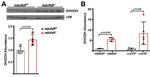 beta-2 Microglobulin Antibody in Western Blot (WB)