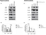 mTOR Antibody in Western Blot (WB)