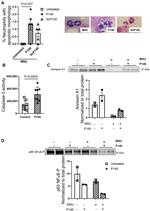 Annexin A1 Antibody in Western Blot (WB)