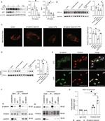 FOXO3A Antibody in Western Blot (WB)