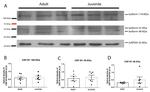 CRHR1 Antibody in Western Blot (WB)