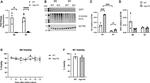 O-linked N-acetylglucosamine (O-GlcNAc) Antibody in Western Blot (WB)