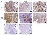 HLA-G Antibody in Immunohistochemistry (IHC)