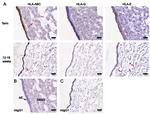 HLA-G Antibody in Immunohistochemistry (IHC)