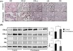 Estrogen Receptor alpha Antibody in Western Blot (WB)