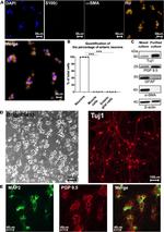 PGP9.5 Antibody in Western Blot, Immunocytochemistry (WB, ICC/IF)