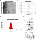 Alix Antibody in Western Blot (WB)