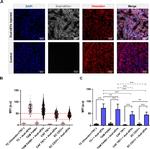 CD31 Antibody in Immunohistochemistry (IHC)