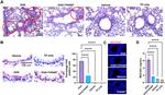 MUC5AC Antibody in Immunohistochemistry (IHC)