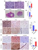 CD31 Antibody in Immunohistochemistry (IHC)