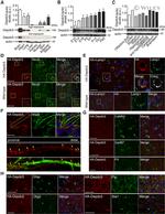 GFAP Antibody in Immunohistochemistry (IHC)