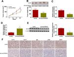 HK2 Antibody in Immunohistochemistry (IHC)