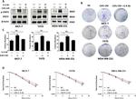 IL-6 Antibody in Neutralization (Neu)