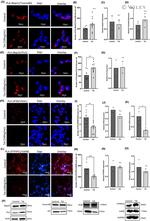 VAPB Antibody in Western Blot, Immunocytochemistry (WB, ICC/IF)