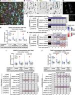 SH2D2A Antibody in Immunocytochemistry (ICC/IF)