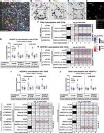 SH2D2A Antibody in Immunocytochemistry (ICC/IF)