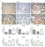 TMPRSS2 Antibody in Immunohistochemistry (IHC)