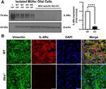 IL-6 Receptor Antibody in Western Blot (WB)