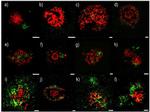 CD230 (PrP) Antibody in Immunohistochemistry (IHC)