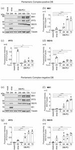 IFIT3 Antibody in Western Blot (WB)