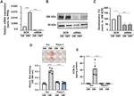 PIEZO1 Antibody in Western Blot (WB)