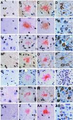 Phospho-Tau (Ser202, Thr205) Antibody in Immunohistochemistry (IHC)