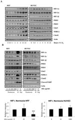 HIF-2 alpha Antibody