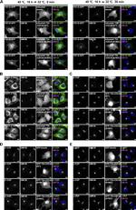 beta COP Antibody in Immunocytochemistry (ICC/IF)