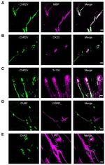 MBP Antibody in Immunohistochemistry (IHC)