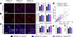 Ubiquitin Antibody in Immunohistochemistry (IHC)