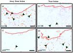 LC3B Antibody in Immunohistochemistry (IHC)